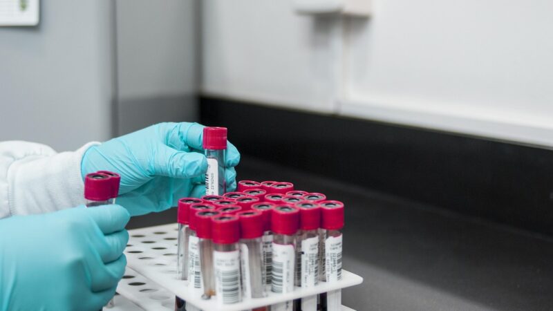 Nematomas pavojus sveikatai: sužinokite, kaip oras keičia kraują ir silpnina jūsų kaulus