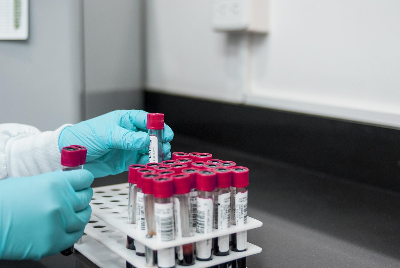 Nematomas pavojus sveikatai: sužinokite, kaip oras keičia kraują ir silpnina jūsų kaulus