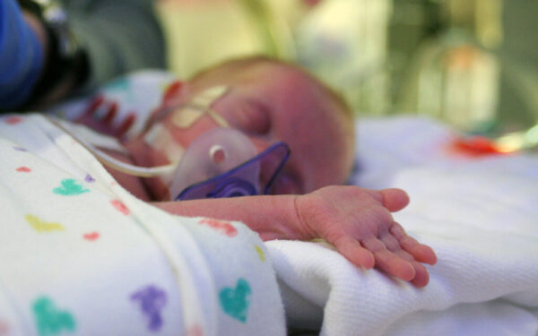 Tokios operacijos Lietuvos istorijoje dar nebuvo: pacientė svėrė vos kilogramą