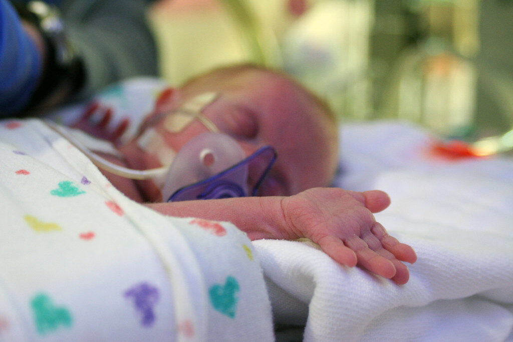 Tokios operacijos Lietuvos istorijoje dar nebuvo: pacientė svėrė vos kilogramą