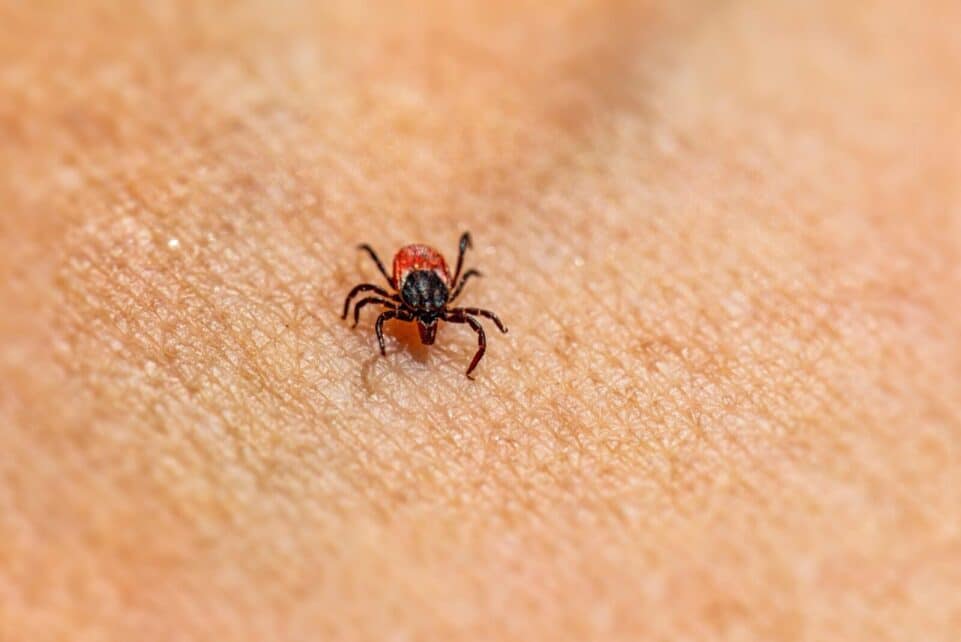 Macro shot of a small tick on human skin. Parasite detail highlighted.
