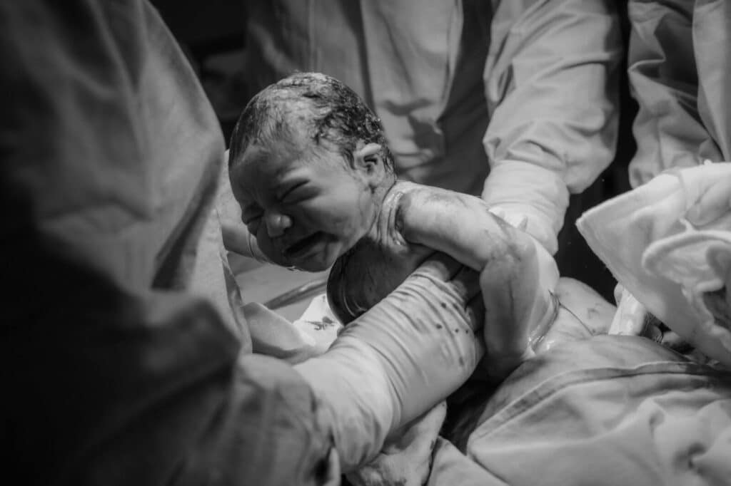 Black and white photograph capturing a newborn baby being delivered in a hospital by medical staff.