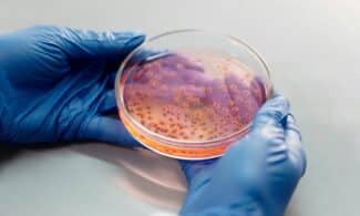 Scientist's hands with gloves examining bacterial culture in a petri dish for laboratory research.