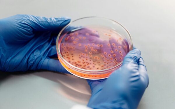 Atrasta netikėta Parkinsono kilmė: paprasti B grupės vitaminai gali tapti proveržiu medicinoje