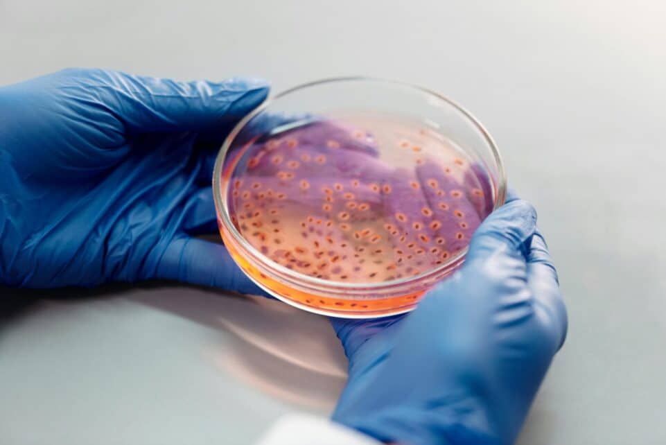 Scientist's hands with gloves examining bacterial culture in a petri dish for laboratory research.