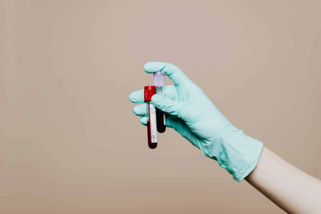 Close-up of a gloved hand holding blood test tubes against neutral background.