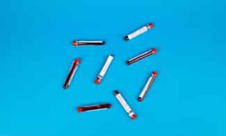 Multiple blood sample tubes arranged on a vivid blue background.