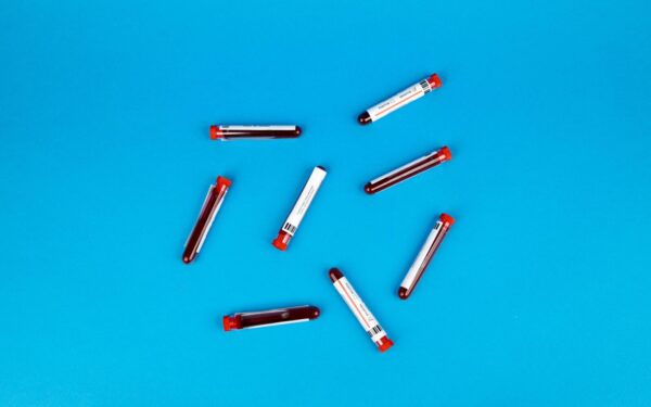 Ši kraujo grupė slepia netikėtą grėsmę: mokslas patvirtino didesnę riziką susirgti diabetu