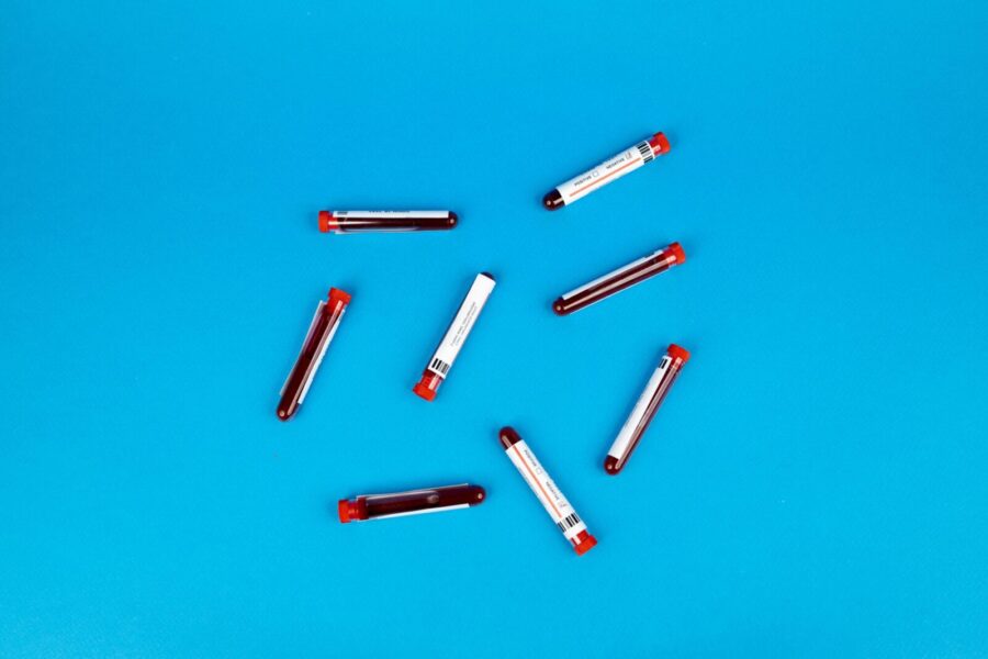Multiple blood sample tubes arranged on a vivid blue background.