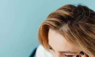 Close-up of a woman with a hand on forehead against a blue background.