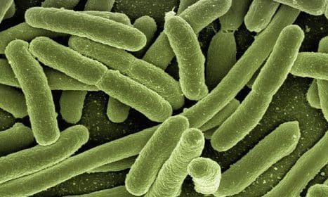 koli bacteria, escherichia coli, bacteria, disease, pathogens, microscopy, electron microscopy, electron microscope, vaccination, immune system, diseases, vaccine, escherichia, infect, infection, risk of infection, pathogen, viruses, bacteria, bacteria, bacteria, bacteria, bacteria