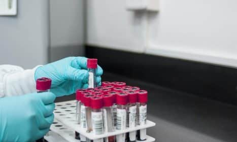 lab, experiment, test, chemistry, test tubes, laboratory, hands, gloves, surgical gloves, blood samples, lab, lab, lab, lab, lab, chemistry, laboratory, laboratory, laboratory, laboratory