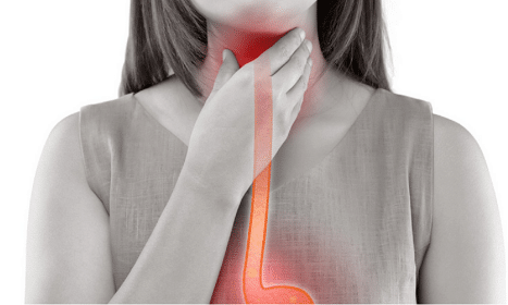 achalasia, achalasia causes, achalasia symptoms, achalasia diagnosis, sore throat, esophagus, sore throat, sore throat, sore throat, sore throat, sore throat, esophagus
