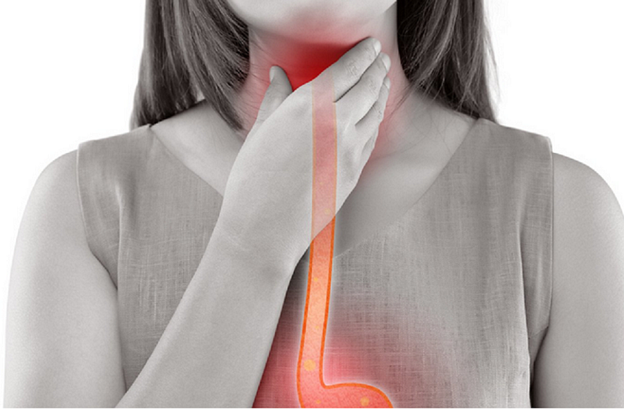 achalasia, achalasia causes, achalasia symptoms, achalasia diagnosis, sore throat, esophagus, sore throat, sore throat, sore throat, sore throat, sore throat, esophagus