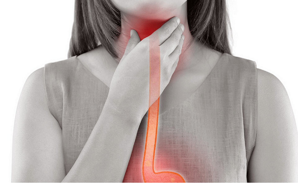 achalasia, achalasia causes, achalasia symptoms, achalasia diagnosis, sore throat, esophagus, sore throat, sore throat, sore throat, sore throat, sore throat, esophagus