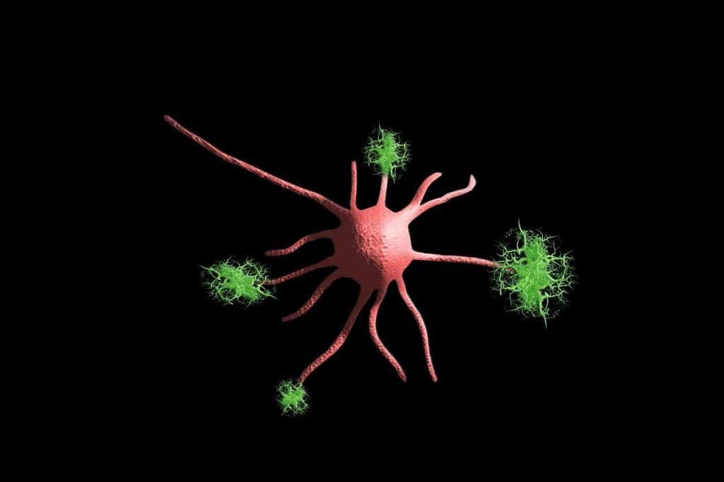 nerve cell, neurons, nervous system, nerves, cell, deposit, plaques, synapse, alzheimer's, dementia, disease, nerve cell, neurons, neurons, nervous system, nervous system, nervous system, nervous system, nervous system, nerves, dementia