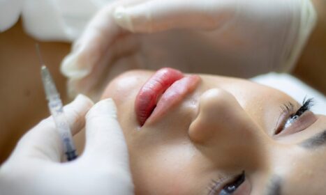 lip filler, beauty, injection, filler, lip augmentation, dermatology, cosmetics, face, lips, girl, woman, closeup, lip filler, lip filler, lip filler, lip filler, lip filler, filler, filler, filler, dermatology, dermatology, dermatology, dermatology