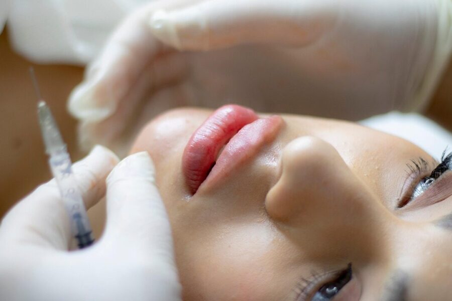 lip filler, beauty, injection, filler, lip augmentation, dermatology, cosmetics, face, lips, girl, woman, closeup, lip filler, lip filler, lip filler, lip filler, lip filler, filler, filler, filler, dermatology, dermatology, dermatology, dermatology