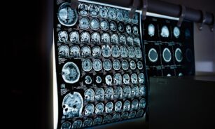 x-ray, mri, ct scan, computed tomography, magnetic resonance imaging, medicine, neurology, healthcare, x-ray, mri, mri, mri, mri, mri, ct scan, medicine, neurology, neurology, healthcare, healthcare