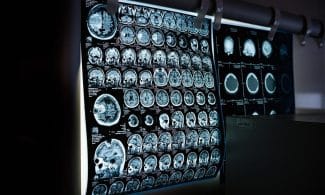 x-ray, mri, ct scan, computed tomography, magnetic resonance imaging, medicine, neurology, healthcare, x-ray, mri, mri, mri, mri, mri, ct scan, medicine, neurology, neurology, healthcare, healthcare