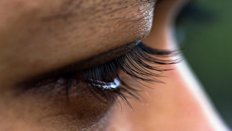 Užkritę vokai trukdo matyti? Chirurgė teigia, kad ignoruodami šiuos pakitimus rizikuojate regėjimu ir gyvybe