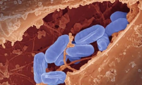 a close up of a blue substance in a vein