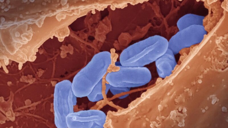 Antibiotikai tampa bejėgiai: štai kokia užmiršta liga vėl kelia didelį pavojų jūsų sveikatai