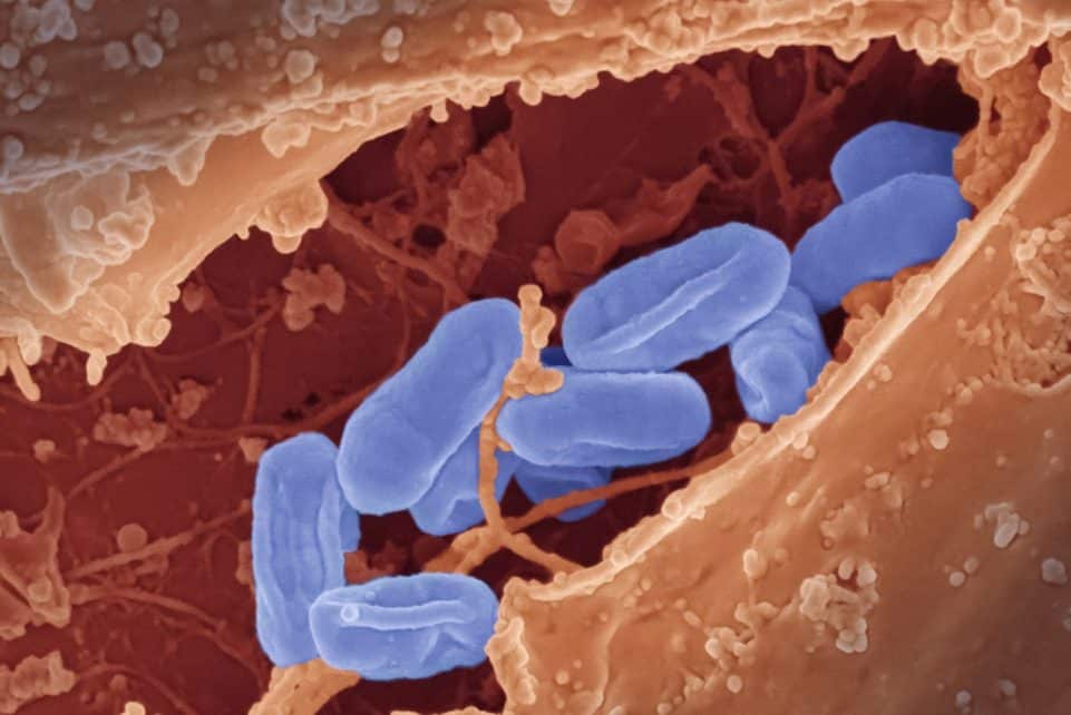 a close up of a blue substance in a vein