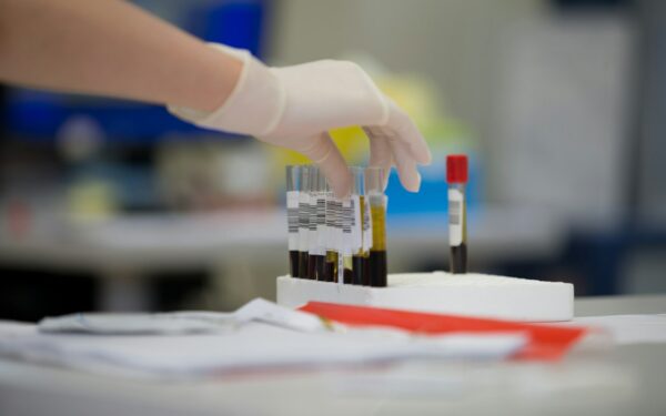 Netikėtas radinys kraujyje: kylantis CO2 lygis keičia jūsų kūno cheminę sudėtį