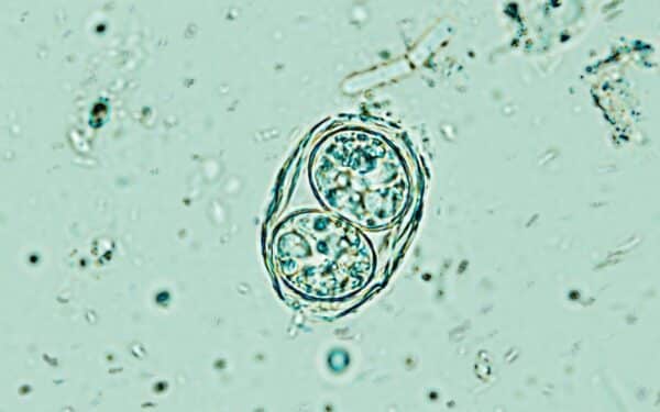 Mokslas perspėja: sužinokite, kodėl jūsų smegenyse gyvenantis parazitas staiga prabudo