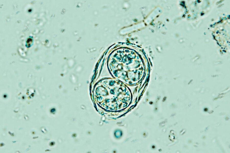 Mokslas perspėja: sužinokite, kodėl jūsų smegenyse gyvenantis parazitas staiga prabudo