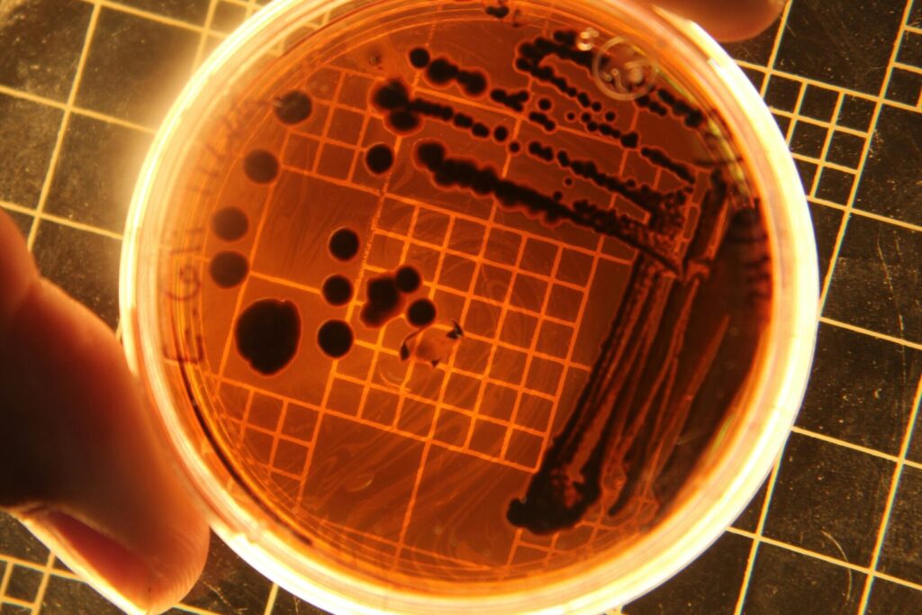 Close-up of bacteria colonies in a petri dish under laboratory conditions.