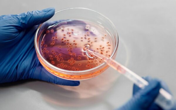 Parkinsono liga slepiasi žarnyne: mokslininkai atskleidė, kaip ją atpažinti dar iki pirmų simptomų