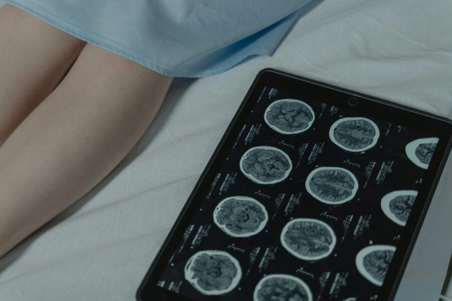 Close-up of brain CT scan display on tablet beside patient's legs in a hospital room.