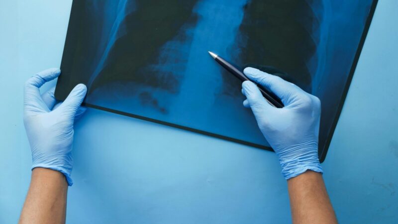 Pamirškite varginantį rentgeną: naujas jutiklis plaučių ligas nustatys tiesiog iš jūsų kvėpavimo