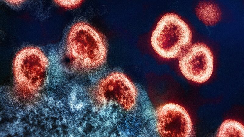 Mokslininkai įveikė ŽIV? Paciento iš Oslo atvejis atskleidė neįtikėtiną pasveikimo paslaptį