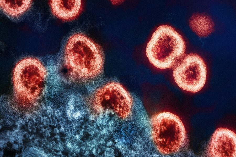 a group of red and black cells on a blue background