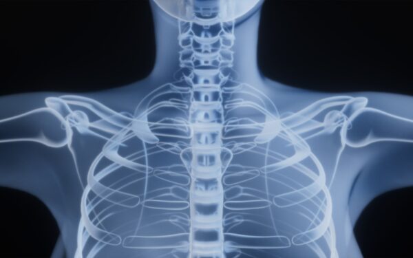 Amžinosios medžiagos taikosi į vaikus: mokslininkai įspėja apie poveikį kaulams