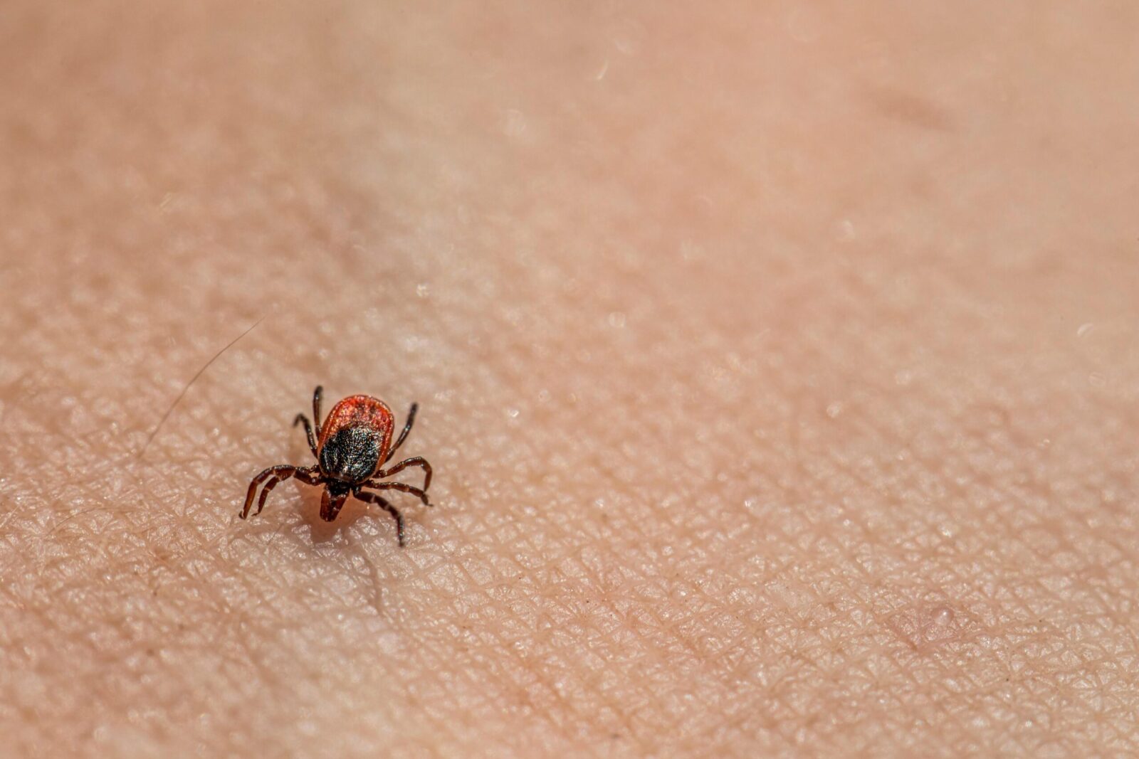 Erkės platina ne tik Laimo ligą: 6 pavojingos infekcijos ir simptomai, kurių negalima praleisti