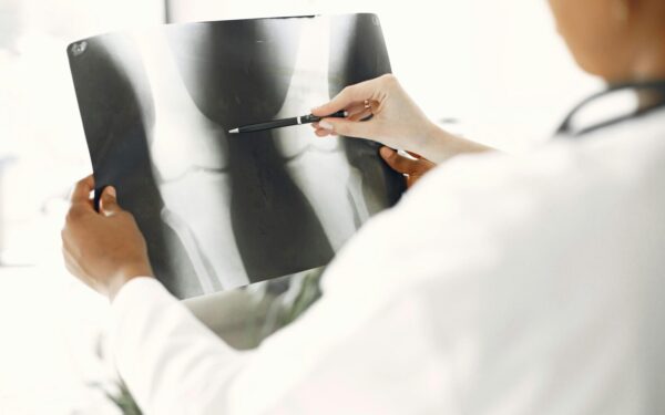 Osteoporozė diagnozuojama vis jaunesniems: gydytojai perspėja, ko nereikėtų ignoruoti