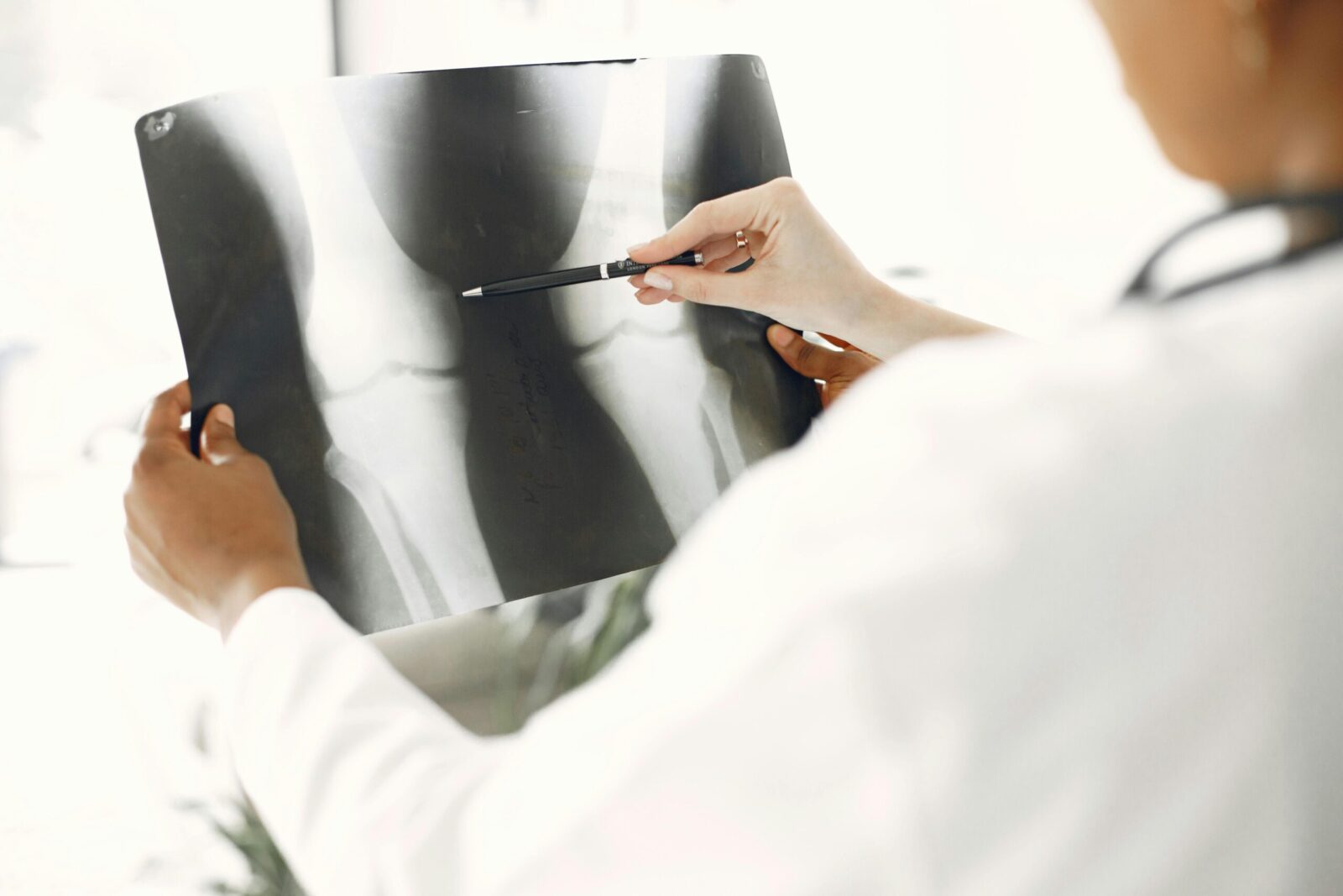 Osteoporozė diagnozuojama vis jaunesniems: gydytojai perspėja, ko nereikėtų ignoruoti