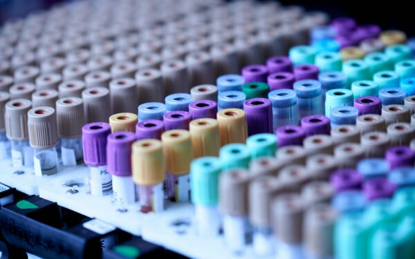 Dirbtinis intelektas keičia mediciną: diagnozės tampa tikslesnės, o vaistai kuriami greičiau
