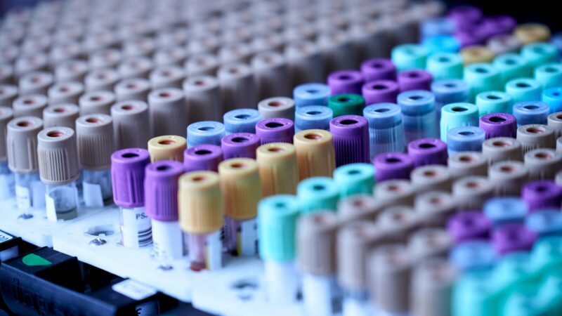 Dirbtinis intelektas keičia mediciną: diagnozės tampa tikslesnės, o vaistai kuriami greičiau