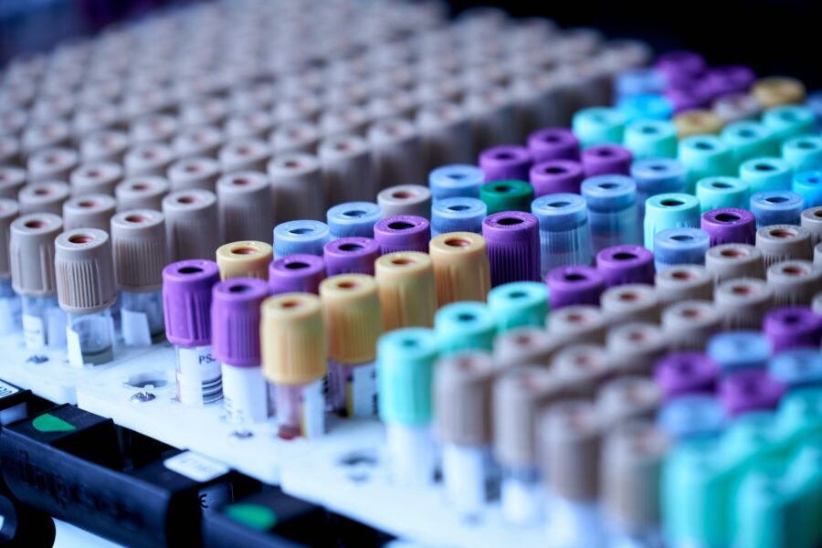 Laboratorija. Unsplash nuotr