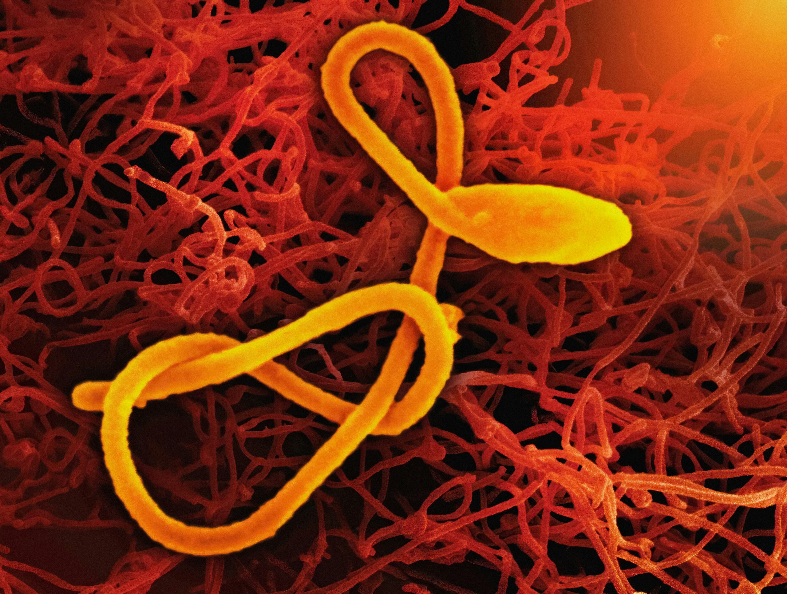 Ebola. Unsplash nuotr